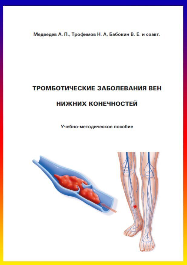 Схемы лечения тромбофлебита нижних конечностей